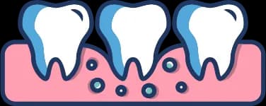 Gum Treatments thumbnail