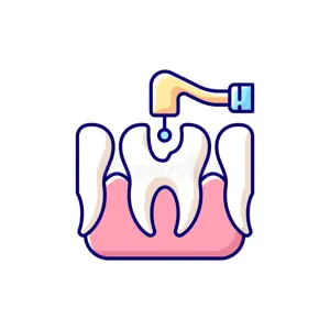 Root Canal Treatment thumbnail